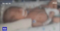 韩国刚出生5天的婴儿昏迷不醒 疑似被护士暴力看护